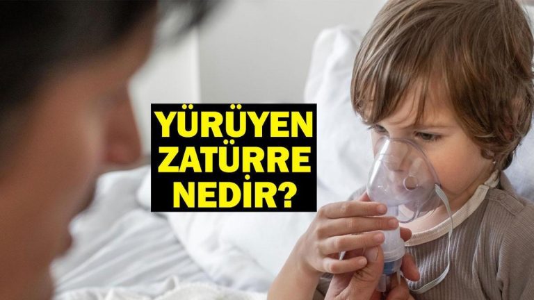 Yürüyen zatürre nedir ve belirtileri nelerdir? Yürüyen pnömoni nasıl bulaşır?