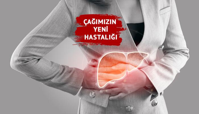 Yeni Yaş Hastalığı: Karaciğer Yağ! Son 30-40 yılda artıyor! Karaciğer yağına neden olur mu? Uzmanların uyarıları …