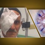 Transplantasyon ile birlikte verilen ışık … 83 yıl boyunca hasta 10 yıl boyunca kornea nakli bekliyor: “Gözlerimi açtınız”
