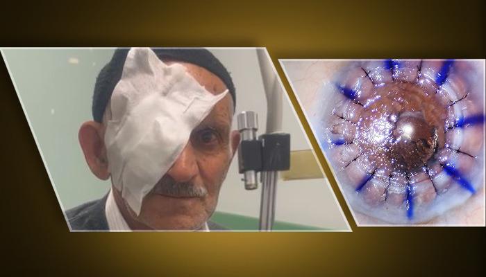 Transplantasyon ile birlikte verilen ışık … 83 yıl boyunca hasta 10 yıl boyunca kornea nakli bekliyor: “Gözlerimi açtınız”