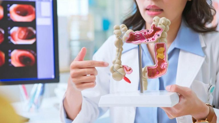 Casso bağırsak görevi nedir? Akıllı bağırsak fonksiyonları ve özellikleri nelerdir?