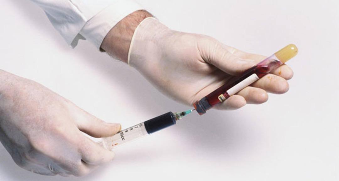 Kuaför ve berbere dikkat: Hepatit kontaminasyonu riski var! Uzmanlar hepatit tehlikesinden uyardı ... 2