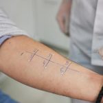 Alerji Testi İçin Hangi Doktora Gidilir? Alerji Testi Hangi Bölüm Bakar?