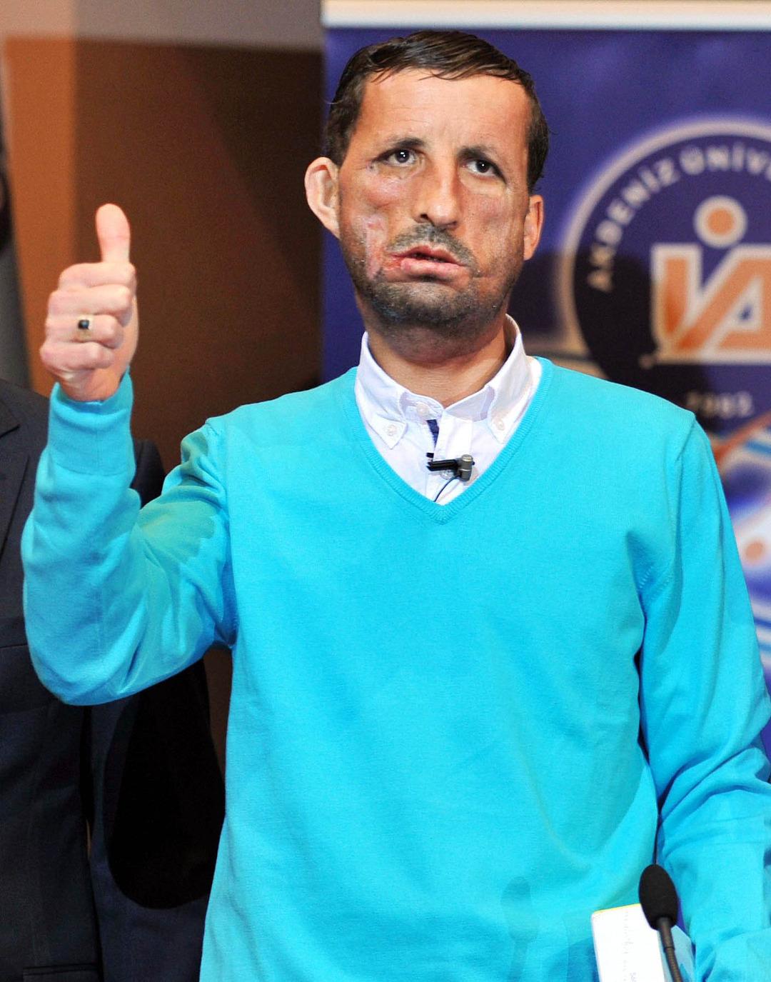 Birincisinin merkezi 50'de organ nakli tabanına yeni bir tane ekledi: Başlatma lansmanları ... 3