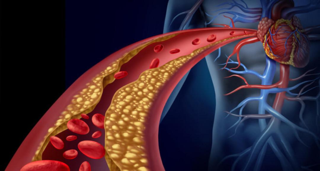 Kardiyolog uzmanından kalp krizini önlemenin 7 önemli yolu 4