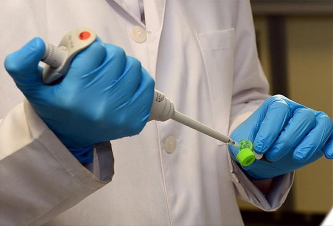 İnfertilite problemleri olan erkekler dikkatli olun: yüzde 30-40 varikosel görülür! Varichosel nedir? 3