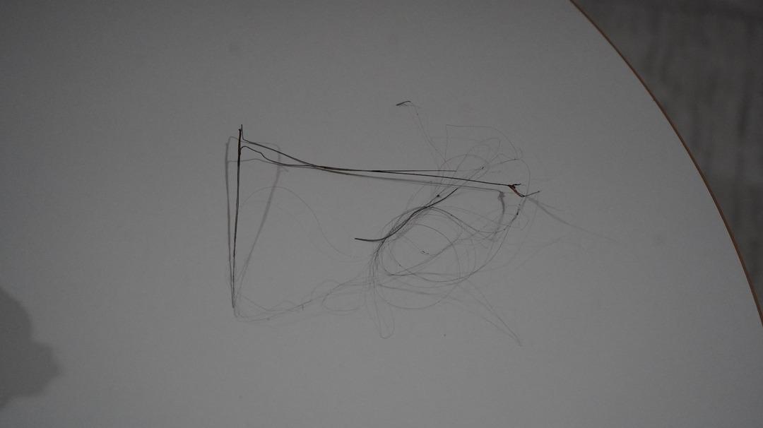 3 yıl sonra ortaya çıktı: 18 santimetre Catharers unuttu! Salatalık yutulduğunda ortaya çıktı 4