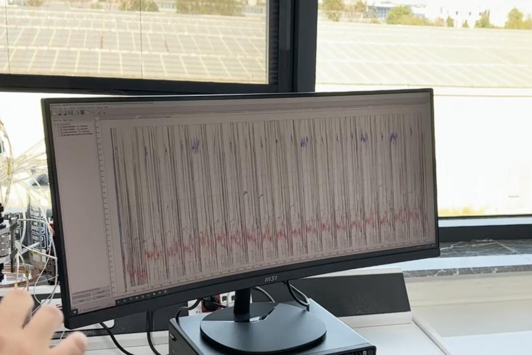 Sağlık Bakanlığı Kemal Memiyoğlu açıkladı: Yerel SMA ilacının ilk müjdesi! 6