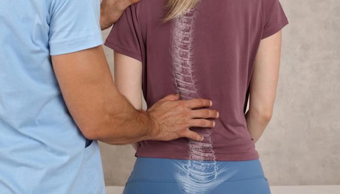 Skolyozda ameliyatsız tedavi yöntemi: ‘Schroth Terapisi’ nedir?