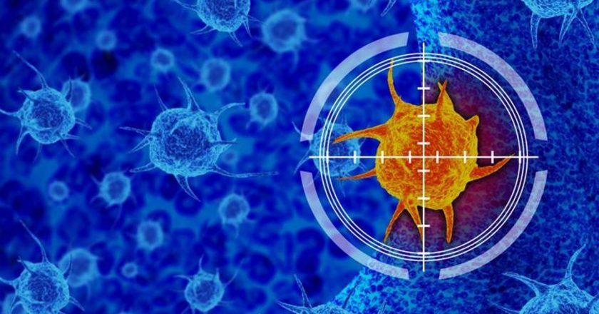 Prostat Kanseri Belirtileri Nelerdir? Prostat Kanseri Nasıl Anlaşılır? Prostat Tedavi Yöntemleri Nelerdir?