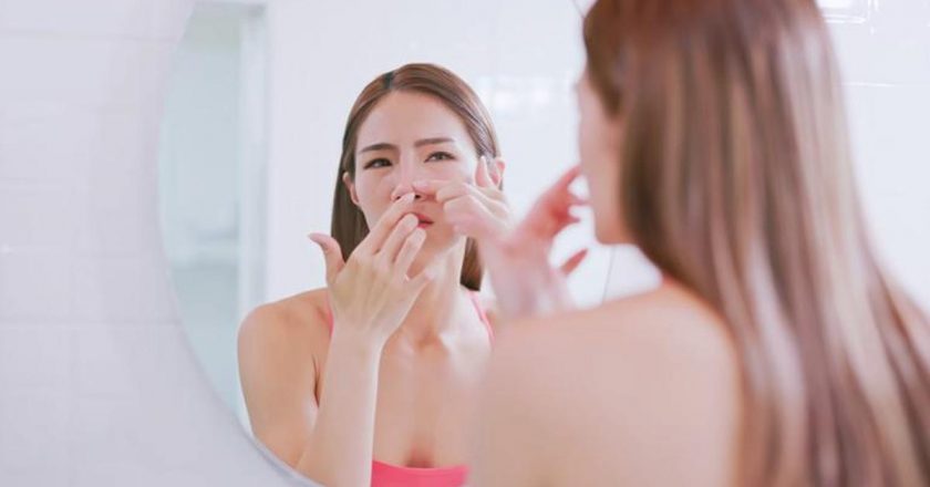 Siyah Noktalar Nasıl Geçer? Siyah Nokta Tedavisi Nasıl Yapılır?