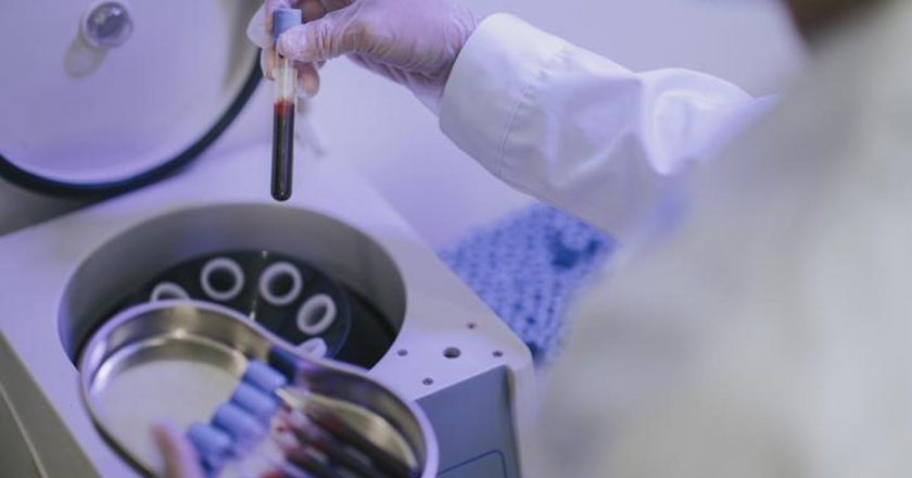 Prp Tedavisi Nedir, Nasıl Yapılır? Prp Tedavisi İşe Yarıyor Mu?