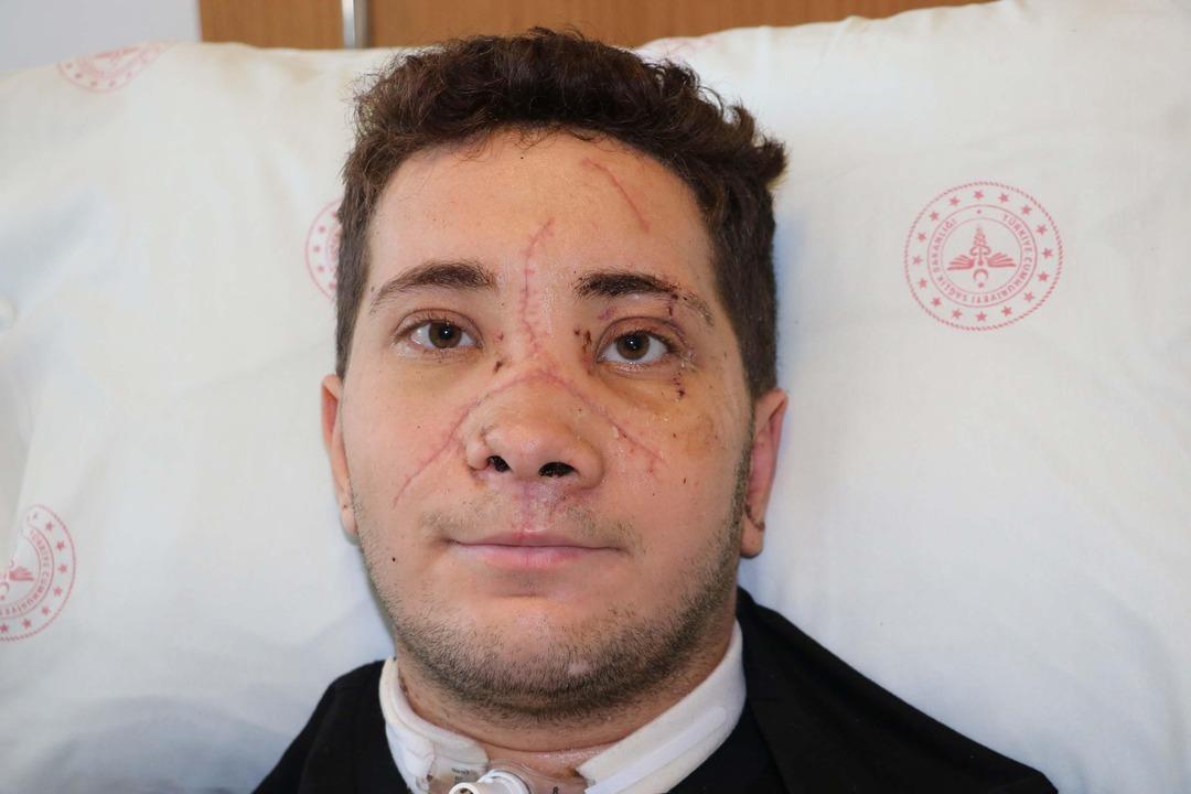 İzmir'de mucize kurtuluş ... Yüzde 90 ölüm riski vardı: Kazada burnunu kırma noktasına ulaşan genç adam 3 3 içeriyor
