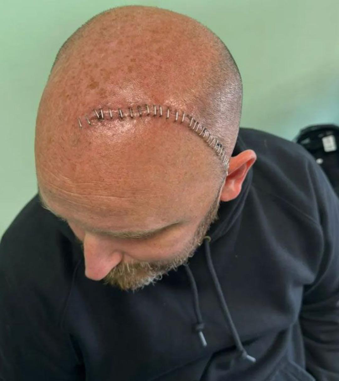 Baş dönmesi şikayetiyle hastaneye gitti: 6 yıl ömrün kaldığını söylediler! Gerçek teşhis sonradan ortaya çıktı! 3