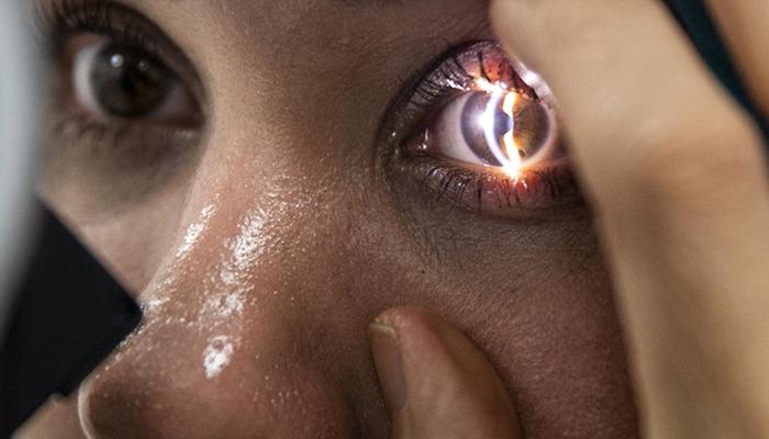 Göz sağlığı şansa bırakılmaz! Doğumdan itibaren düzenli takip edilmelidir! Uzman isim uyardı…