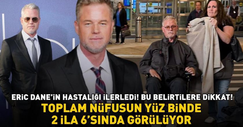 Euphoria’nın yıldızı Eric Dane’nin hastalığı ilerledi! Bu belirtilere dikkat! Toplam nüfusun 100 binde 2 ila 6’sında görülüyor