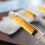 Plazma tedavisi nedir, nasıl uygulanır?