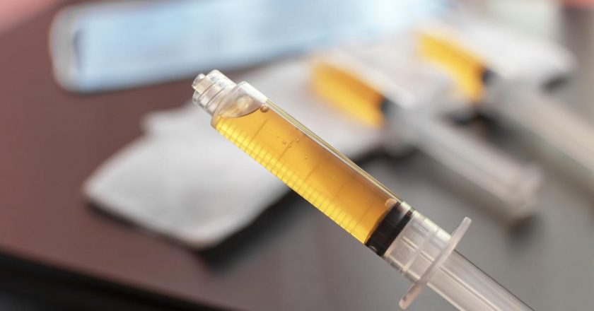 Plazma tedavisi nedir, nasıl uygulanır?